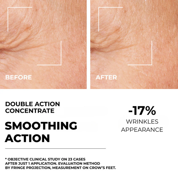 Συμπυκνωμένος ορός διπλής δράσης, 30 ml